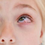 pink eye adult pediatric eyecare local eye doctor near you.jpg
