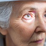 glaucoma adult pediatric eyecare local eye doctor near you.jpg